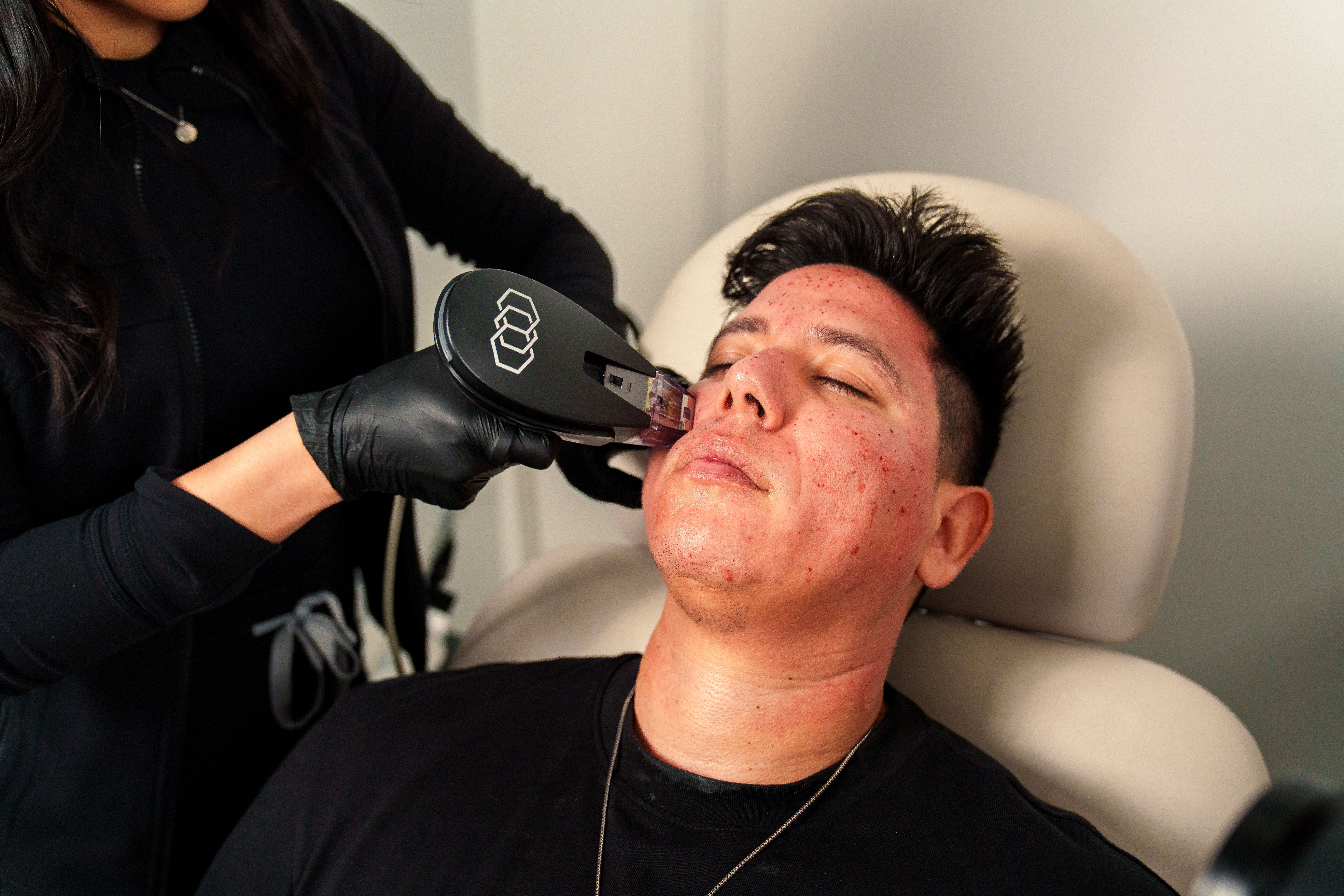Pigmentation Correction