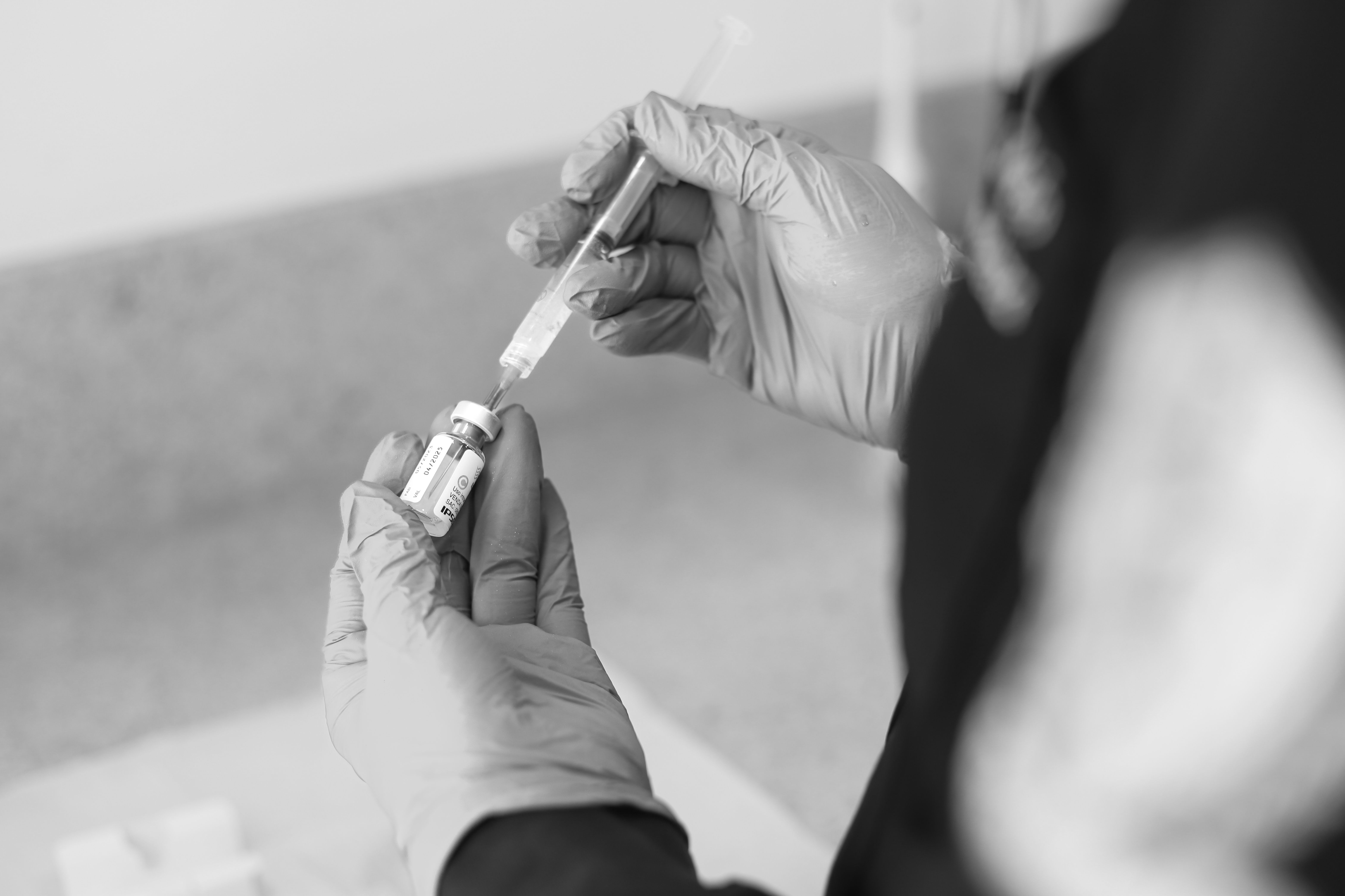 Hyperhidrosis Treatment